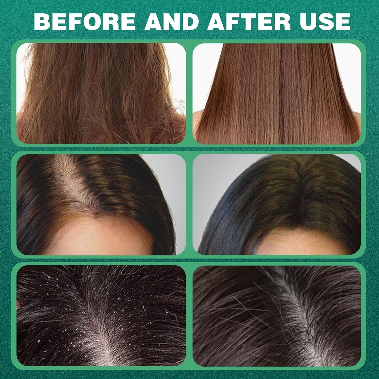 Cypress Leaf Hair Growth Soap Pure Herbal Formula For Natural Hair