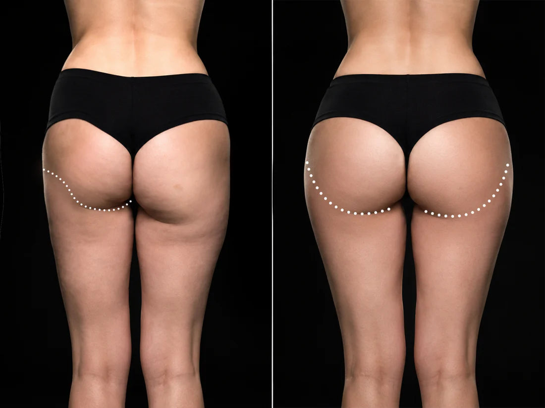 Wearable EMS Shorts for Core Support, Muscle Tension, and a Firmer-Looking Shape