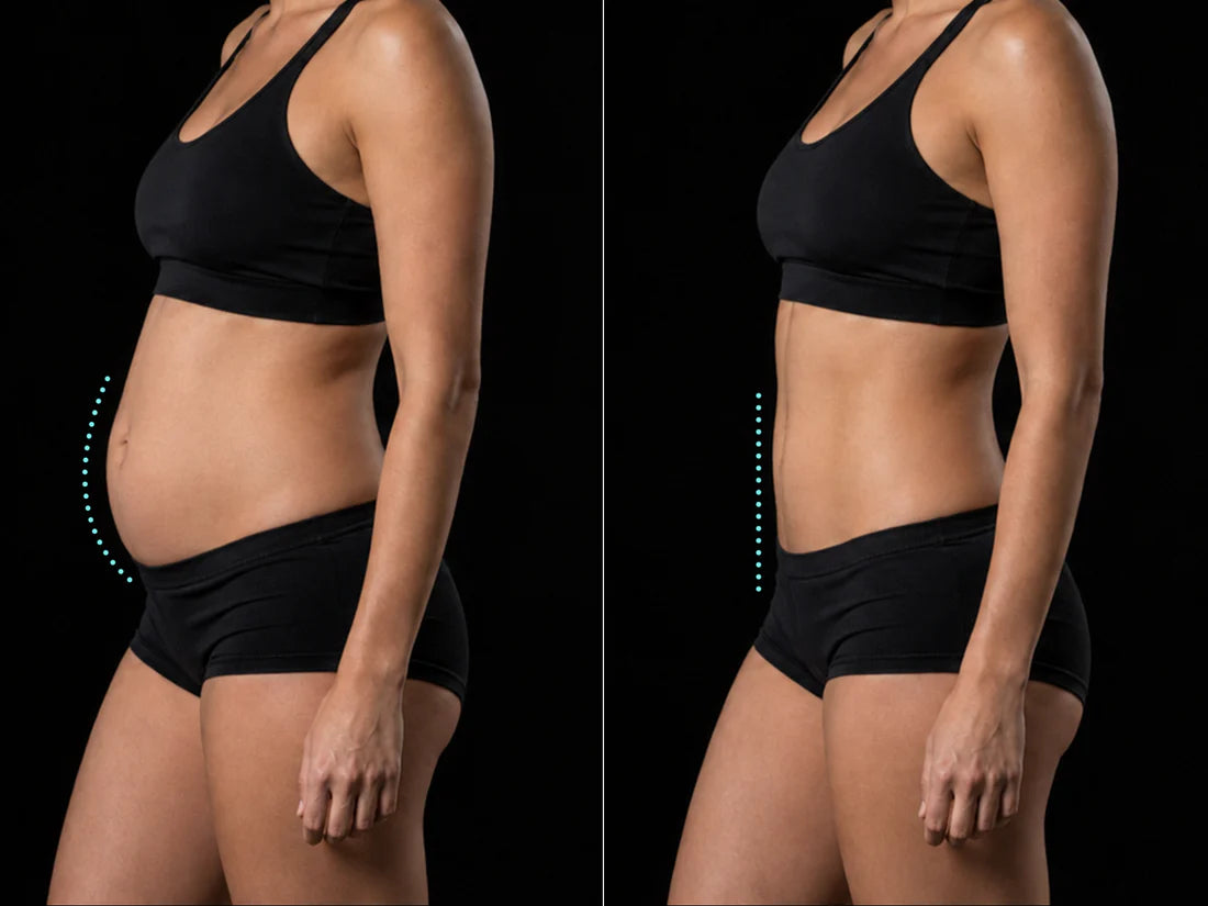 Wearable EMS Shorts for Core Support, Muscle Tension, and a Firmer-Looking Shape