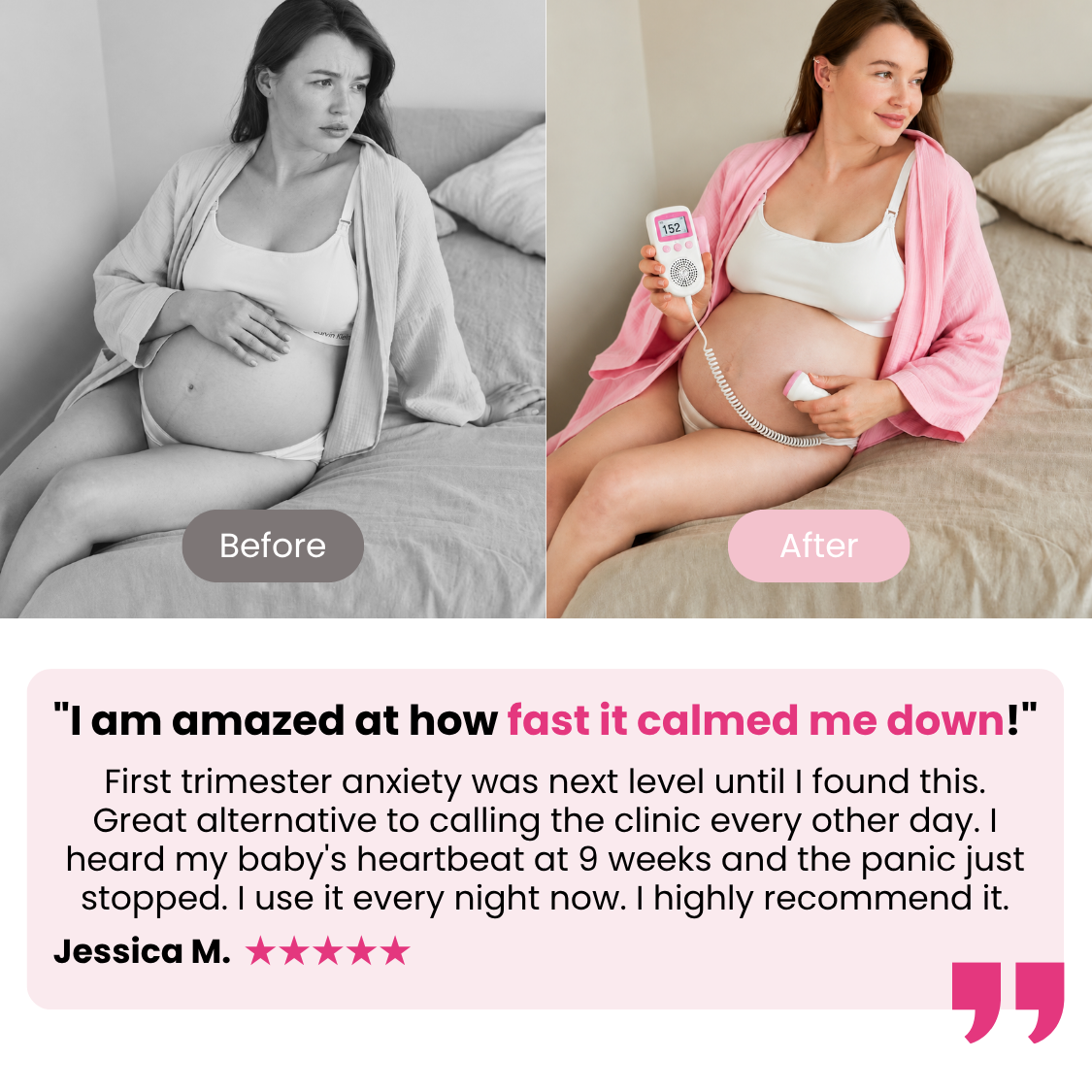 Listen, Bond, Reassure – At-Home Heartbeat Listener for Expecting Parents