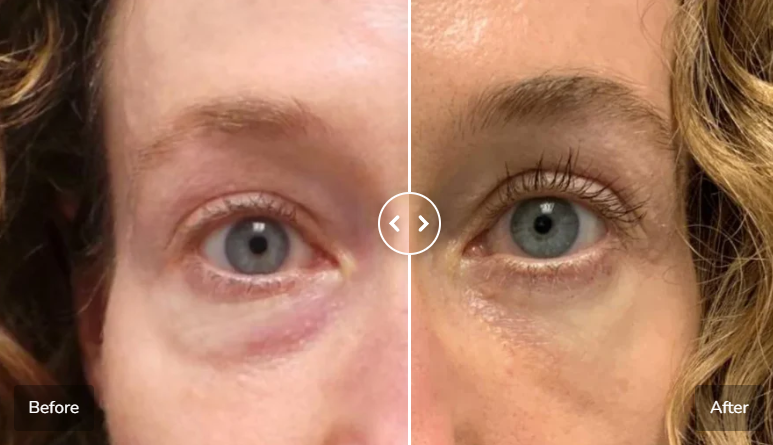 Red Light Eye Massager for Puffy, Tired Eyes