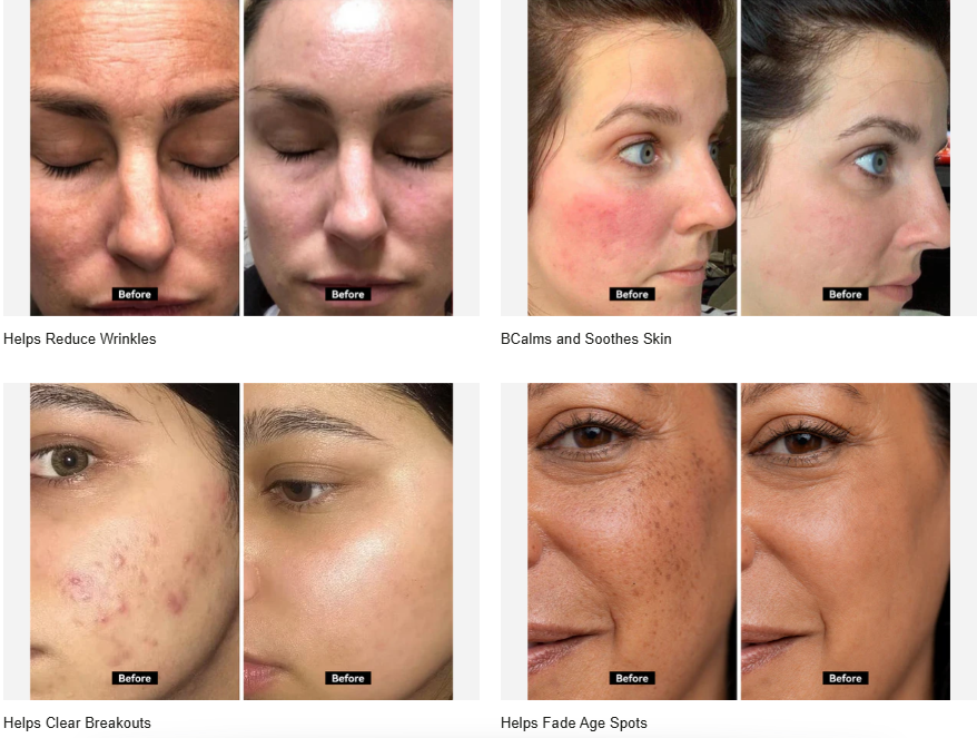 Facial Light Therapy & Misting Panel for Skin Fatigue, Redness, and Daily Rejuvenation