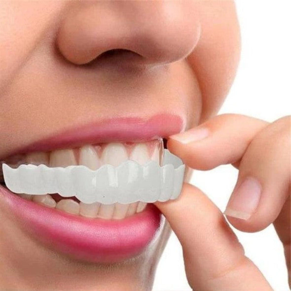 طقم أغطية أسنان بتصميم قشور - واقٍ تجميلي أمامي من قطعتين