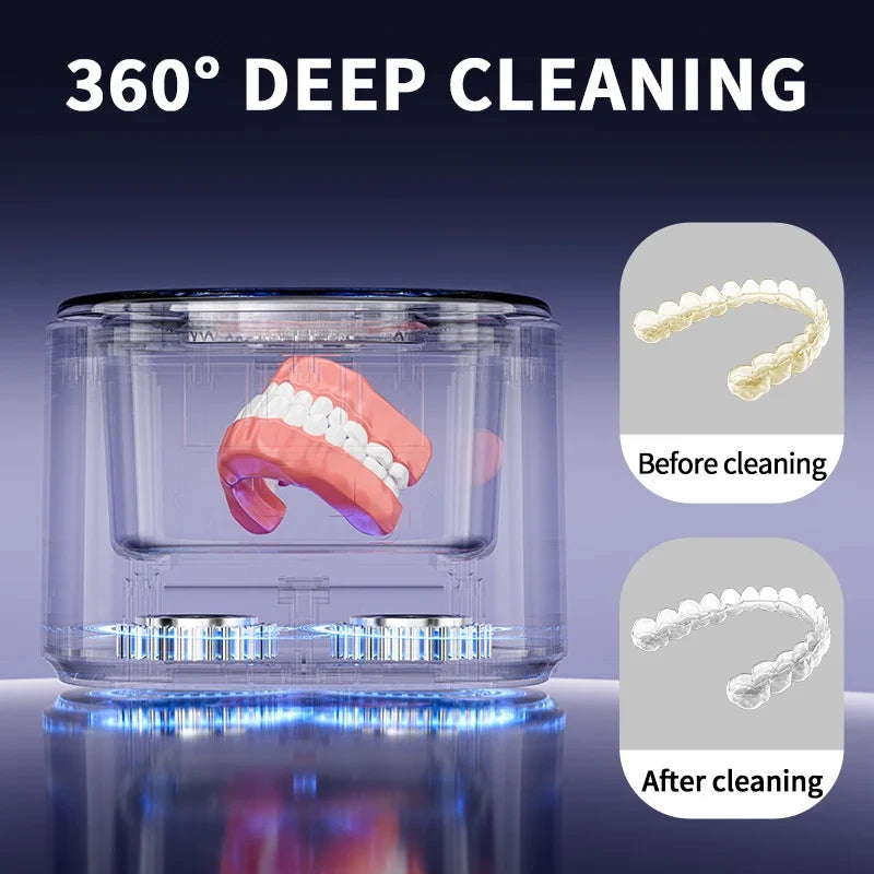 Ultrasonic Cleaner - 50kHz - USB Rechargeable - Braces, Retainers, Dentures & Jewellery | meowbutter