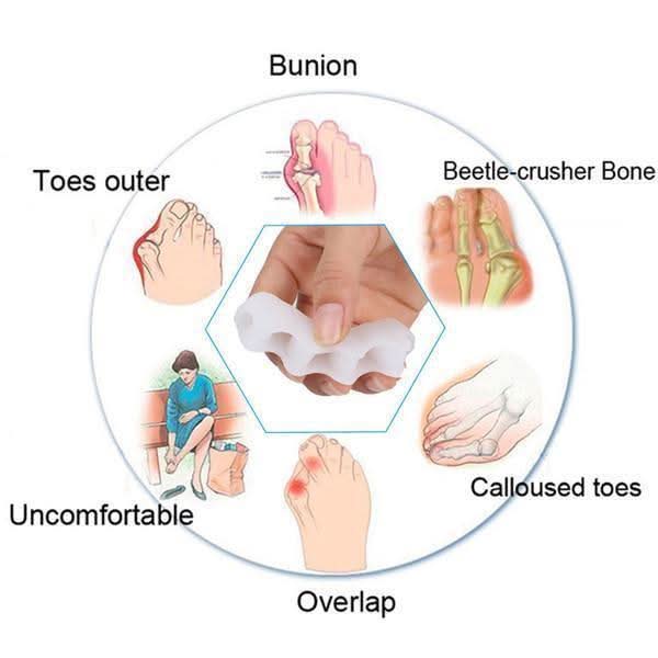 Adjustable Toe Straightener for Pain Relief & Comfort | meowbutter