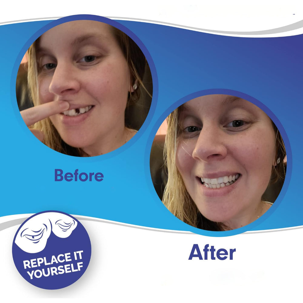Teeth Veneer Cosmetic Cover Set Smile Enhancement | Meowbutter