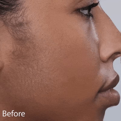 Advanced Sonic Dermaplaning Tool for Smooth, Radiant Mature Skin