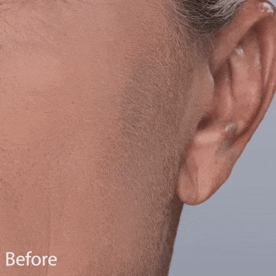 Advanced Sonic Dermaplaning Tool for Smooth, Radiant Mature Skin